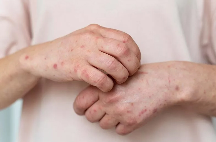 Oddział Dermatologiczny zdj 3