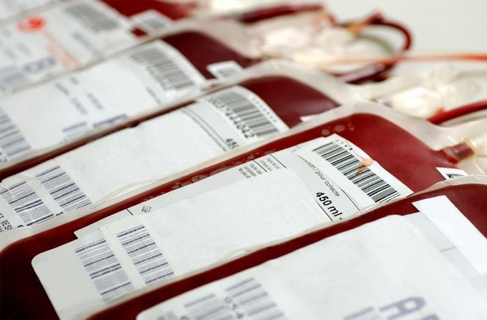 Pracownia Serologii Transfuzjologicznej Szpital Krosno zdj 1